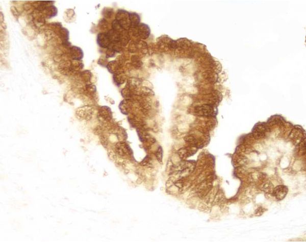 DAB Substrate Kit, Peroxidase (HRP), with Nickel, (3,3-diaminobenzidine)  SK-4100