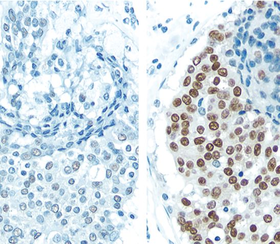 Antigen Retrieval 