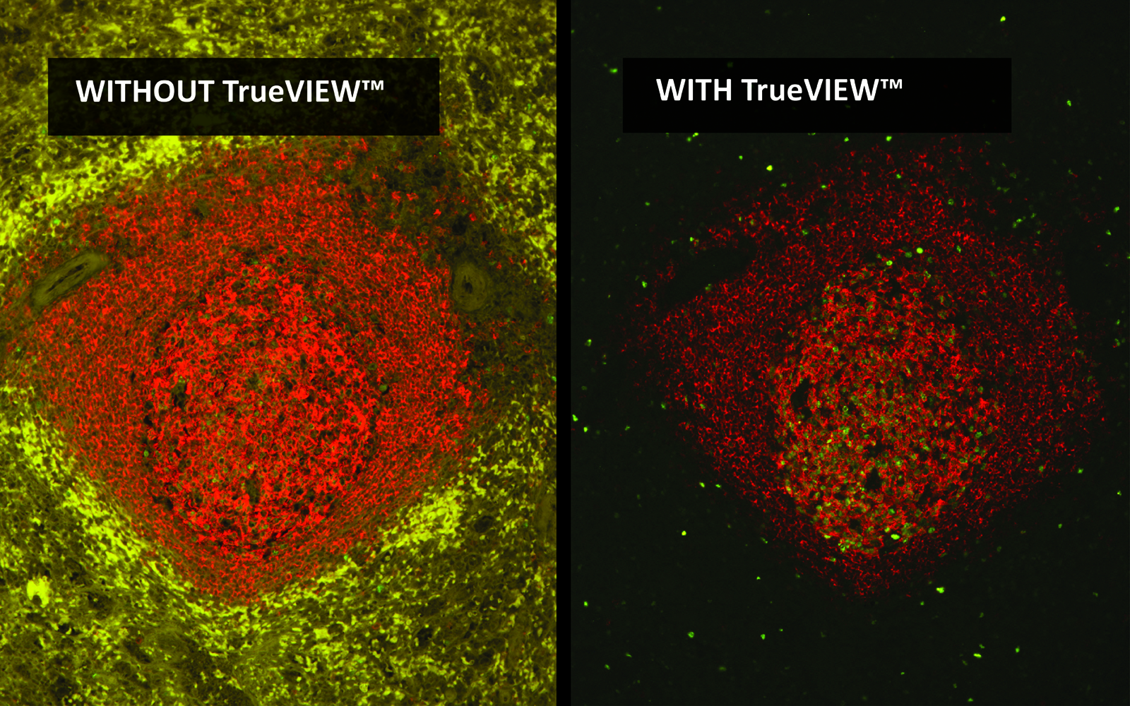 Autofluorescence Quencher