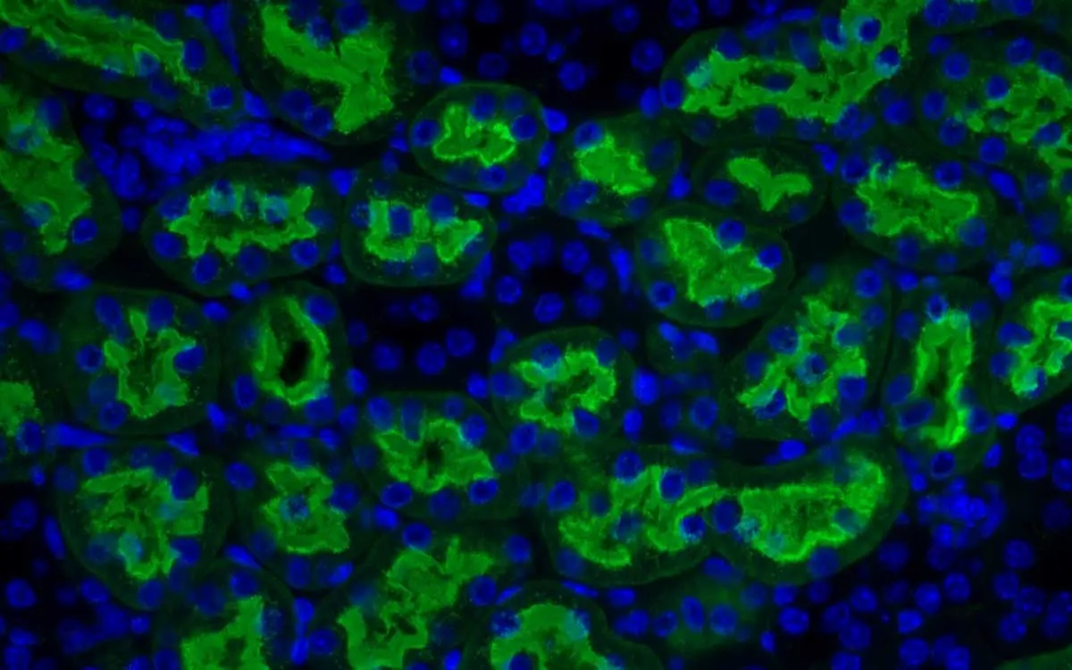 Glycan Analysis