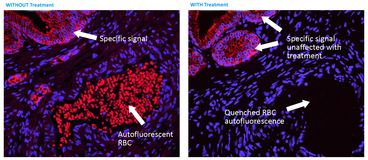 Autofluorescence Quencher